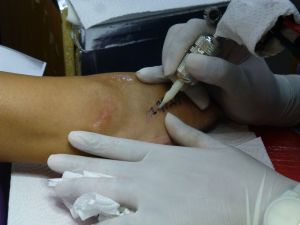 Yup, it hurt a little...